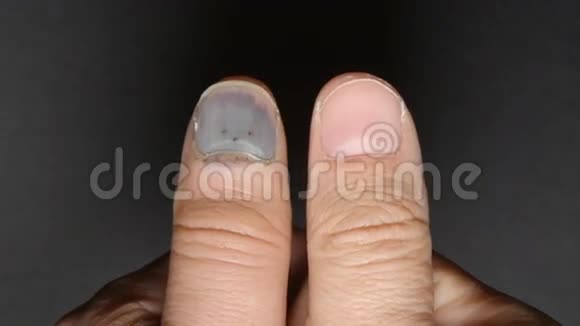 发黑健康的指甲视频的预览图