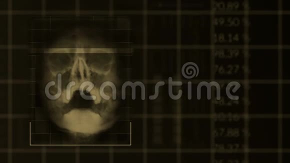 扫描一个人的头骨循环的棕色硬毛腿接口医疗设备视频的预览图