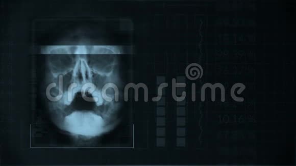 扫描一个人的头骨循环格雷胡德接口医疗设备视频的预览图