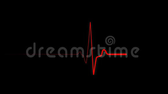 心跳平线屏幕上的心脏冲动序列视频的预览图