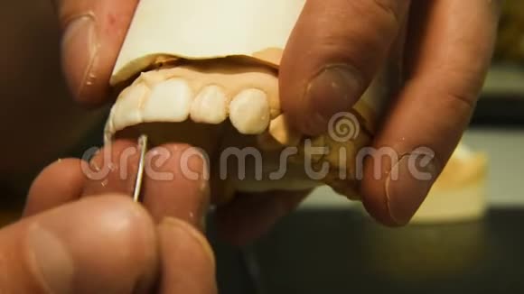 牙医做种植牙视频的预览图