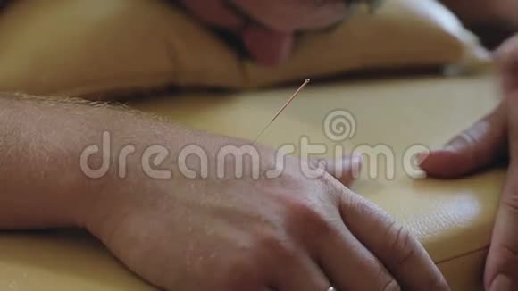 医生从病人手臂上取出针灸针视频的预览图