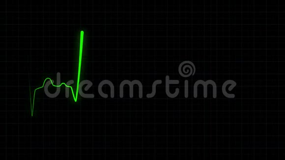 心电图心跳绿线循环动画视频的预览图