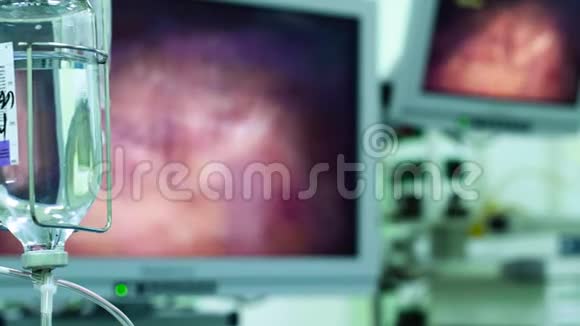 术中腹腔镜监护视频的预览图