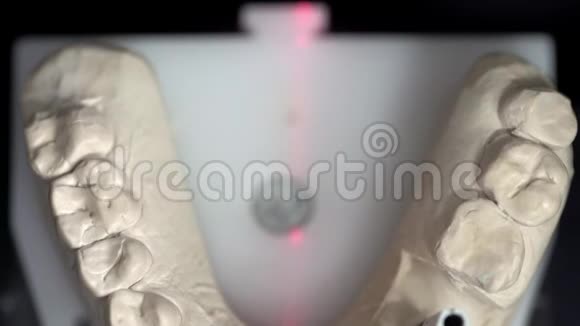 牙科3D扫描仪扫描过程中的特写镜头视频的预览图