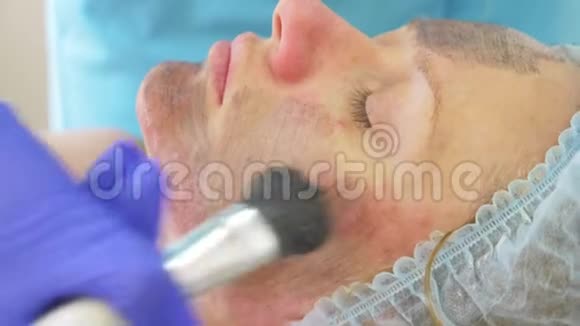 碳面膜治疗激光脉冲清洁面部皮肤硬件美容治疗碳剥落视频的预览图