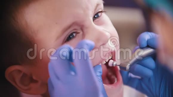 牙医牙医在给孩子擦牙视频的预览图