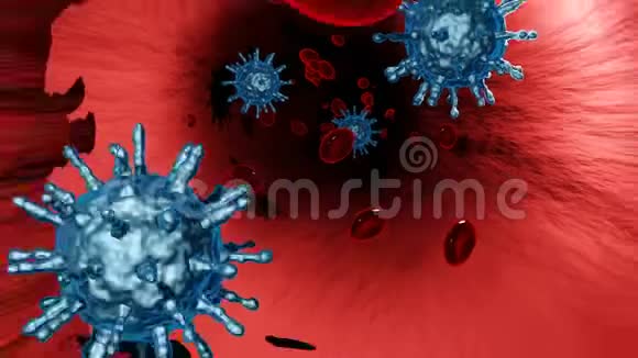 冠状病毒疾病COVID19感染医学图解中国病原呼吸道流感covid病毒细胞新官员视频的预览图