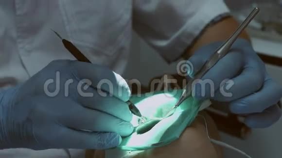 在牙科诊所做手术的女人牙医带着助理把牙印视频的预览图