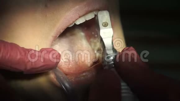 迷人的女孩从牙医那里治疗牙齿视频的预览图