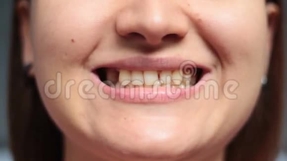 拔牙后露出牙齿和一个洞的女孩视频的预览图