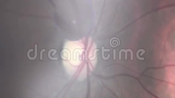现代医学检验中的一只充满红色血管的眼睛的显微镜极端宏观特写镜头视频的预览图