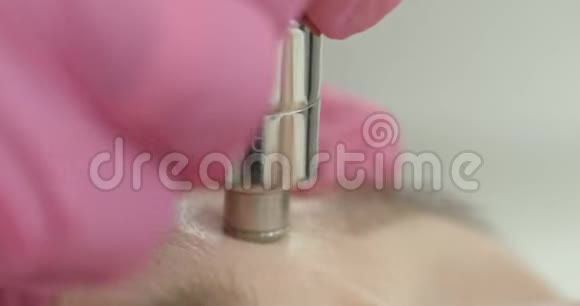 真空微磨损近距离观看美容师双手使用专用机器进行剥皮面部防反视频的预览图