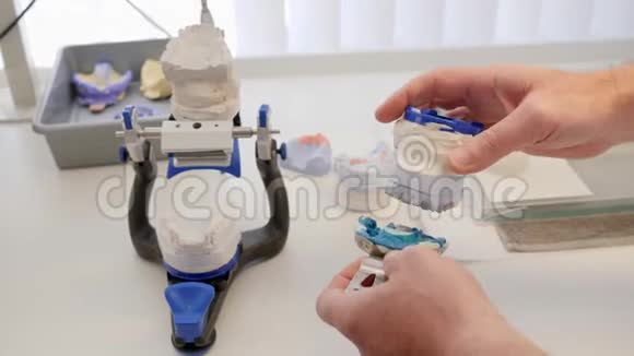 现代医学技术牙科医生用白色和蓝色的特殊塑料块制作修复牙齿视频的预览图