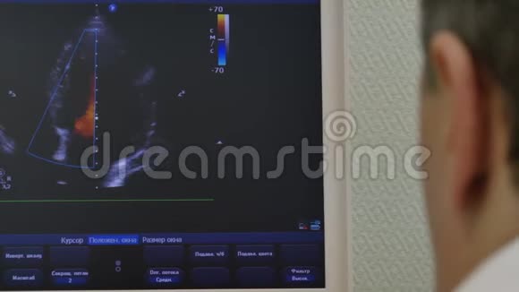 心脏超声对医疗设备的监测视频的预览图