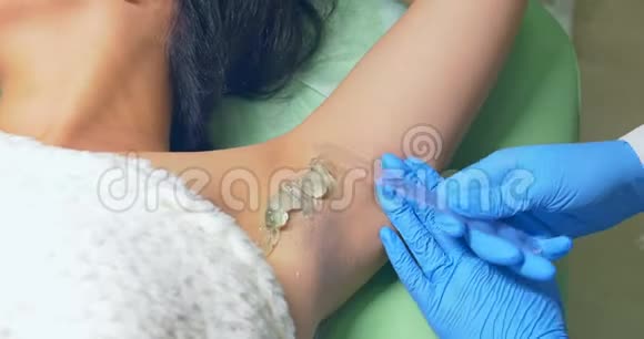 医生在美容过程中使用凝胶激光脱毛和美容美容水疗诊所视频的预览图