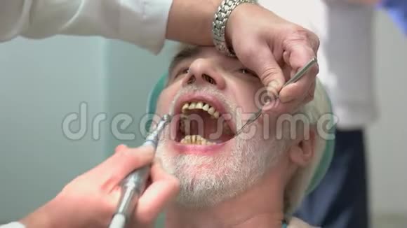 牙科抛光牙齿视频的预览图