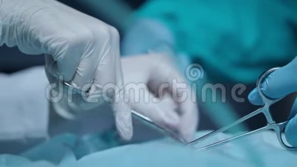 外科手执行手术外科手术手视频的预览图