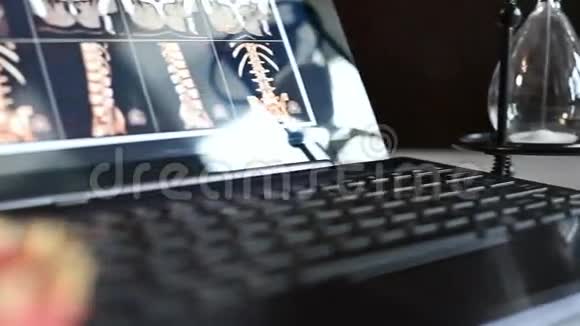 屏幕上带有X光脊柱的笔记本电脑视频的预览图