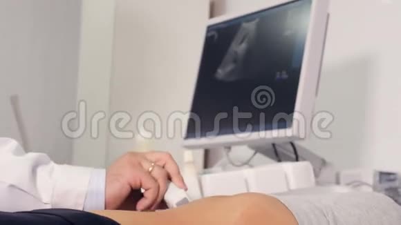 做腹腔超声检查的医生的特写视频的预览图