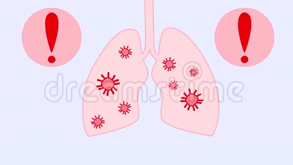 一个人的肺部和呼吸系统中的Covid19或皇冠病毒的动画病毒的传播视频的预览图