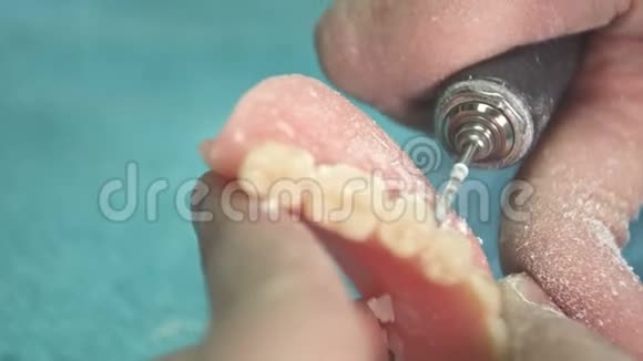 牙科用石膏制成的牙科种植假体视频的预览图
