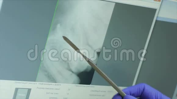 牙科医生给女性病人做X光检查视频的预览图