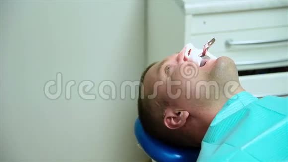 口腔内有牙囊的病人视频的预览图
