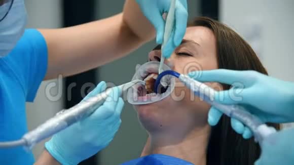 专业牙科清洁视频的预览图