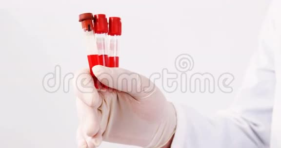 实验室技术人员在试管中抽取血样视频的预览图