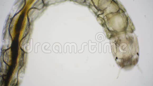 摇蚊幼虫或不叮咬的蠓幼虫的显微镜观察视频的预览图