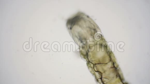 摇蚊幼虫或不叮咬的蠓幼虫的显微镜观察视频的预览图