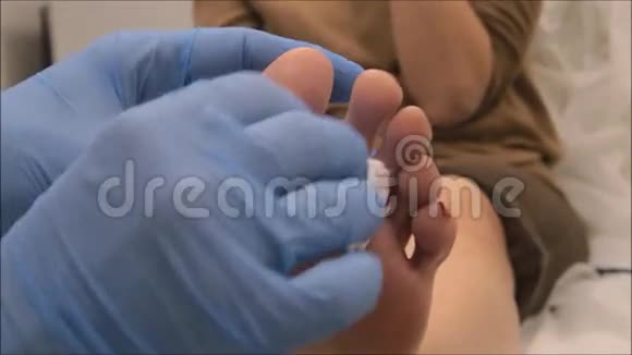皮肤科医生在足部进行局部麻醉以切除足底疣视频的预览图