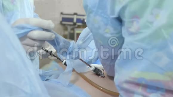 外科医生遵循腹腔镜手术视频的预览图