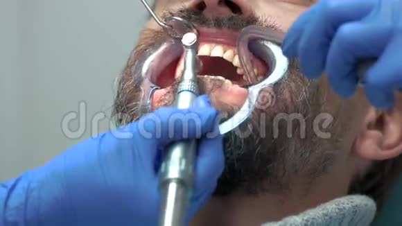 牙医刷牙时要把牙齿贴紧视频的预览图