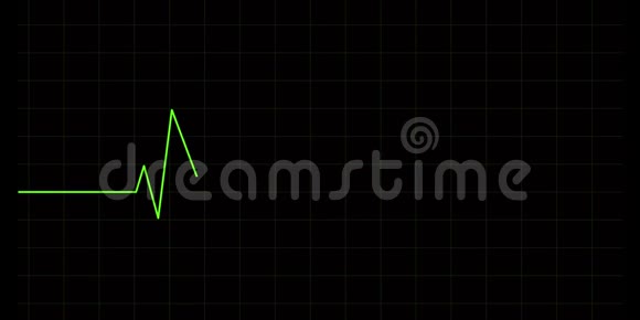 心电图4k心脏搏动脉搏视频的预览图