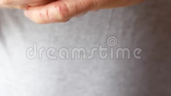 一个手有湿疹的人男性双手特写视频的预览图