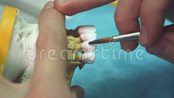 牙科技师将陶瓷釉用数控牙科机铸造而成视频的预览图