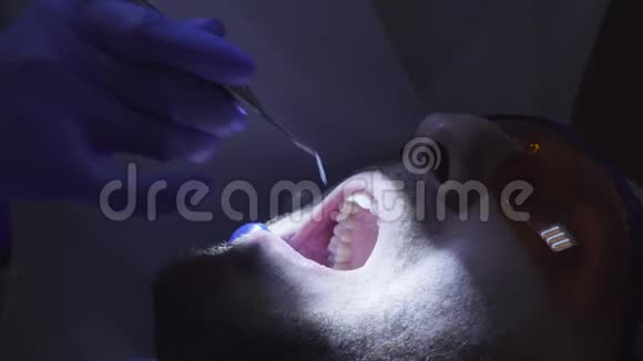 牙医在牙齿上放置复合填充物视频的预览图