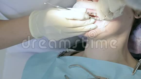一名女牙医在一岁时检查一名女病人的口腔高级关键专业工作视频的预览图