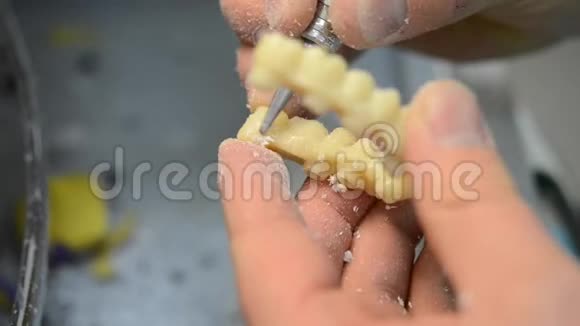 牙医手磨牙冠视频的预览图