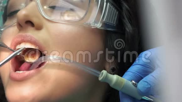 牙医正在使用水注射器视频的预览图