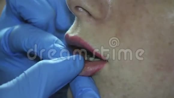 一个增加嘴唇的镜头视频的预览图