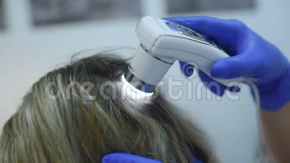 旋毛镜是检查头发的一种方法视频的预览图