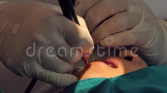 关闭专业牙科治疗牙齿视频的预览图