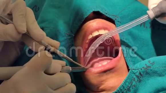 关闭专业牙科治疗牙齿视频的预览图