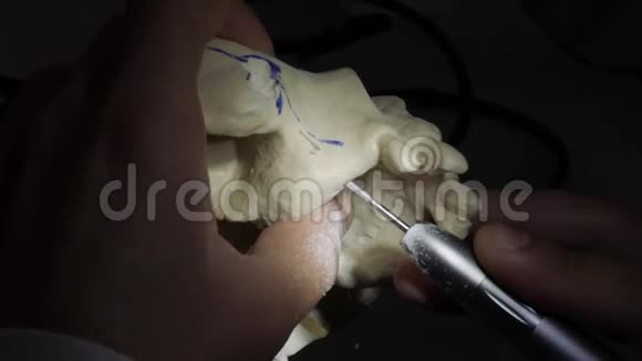 牙科医生拿着一个人的下巴模型视频的预览图