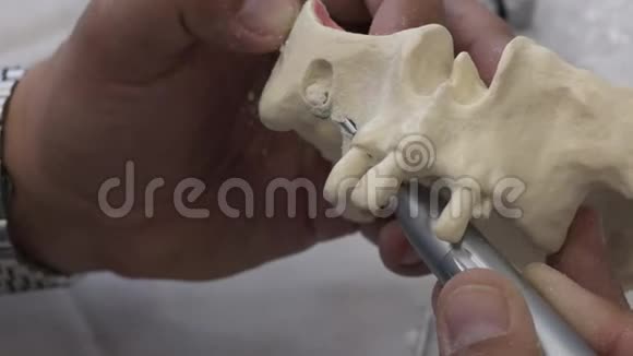 牙科医生拿着一个人的下巴模型视频的预览图