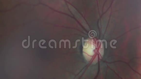 现代医学检验中的一只充满红色血管的眼睛的显微镜极端宏观特写镜头视频的预览图