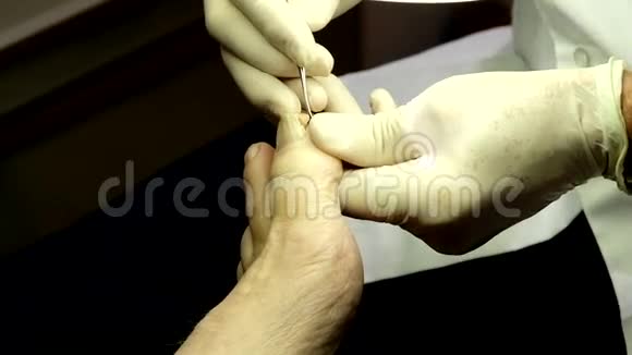 皮肤科医生与病人指甲合作视频的预览图